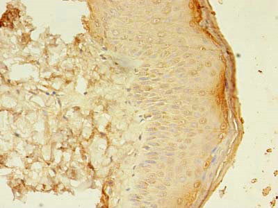 SMAD1 Antibody