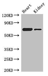 ETFDH Antibody