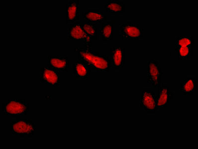 KLF1 Antibody