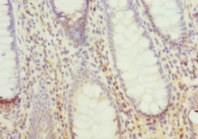 PPP2R5C Antibody