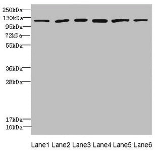 UBE4A Antibody