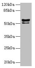 KRT72 Antibody