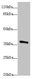 POU4F3 Antibody