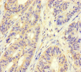 MAPRE1 Antibody