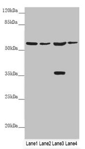 SLC1A5 Antibody