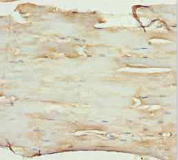 SLC1A5 Antibody