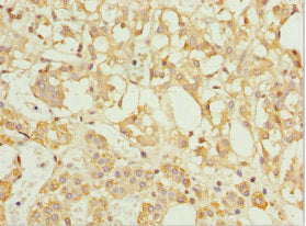 TFCP2 Antibody