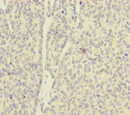 SKIV2L Antibody