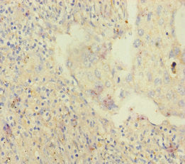 SKIV2L Antibody
