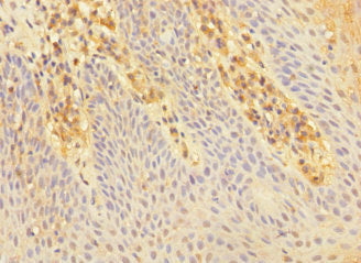 CHRNA2 Antibody