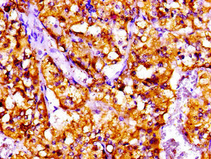 CTF1 Antibody