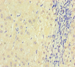 DGUOK Antibody