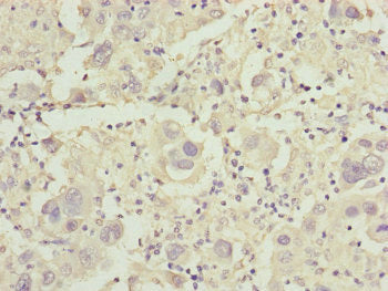 CDO1 Antibody