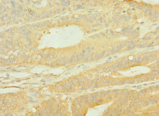 SLC10A2 Antibody