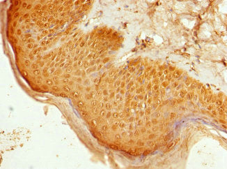 SEMA3B Antibody