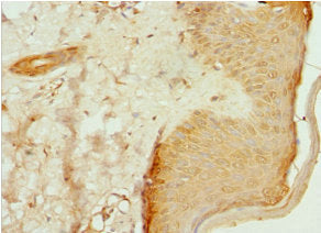 ITGB3BP Antibody