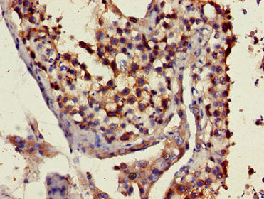 ART3 Antibody