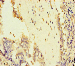 ATR Antibody