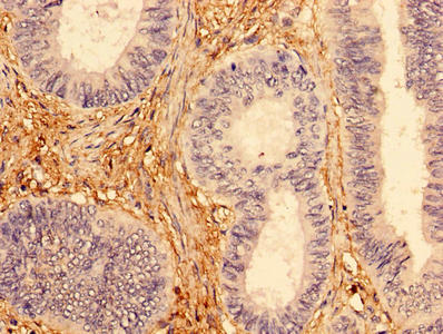 INPP5A Antibody