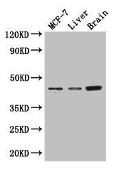 KCNJ11 Antibody