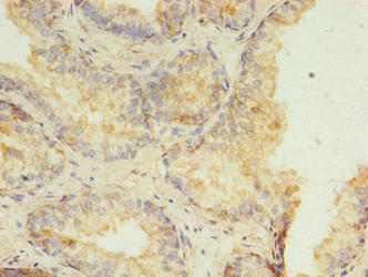 HMGN3 Antibody