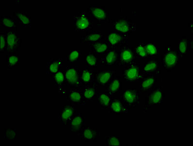 PTPN14 Antibody