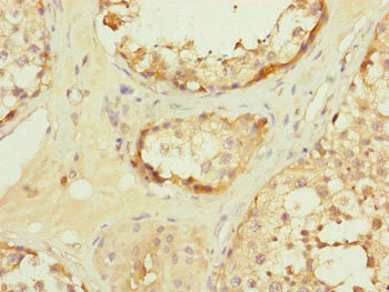 TOMM34 Antibody