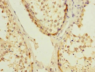 UBE2S Antibody