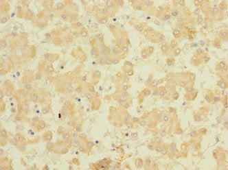 FAM187B Antibody