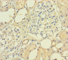 SMARCB1 Antibody
