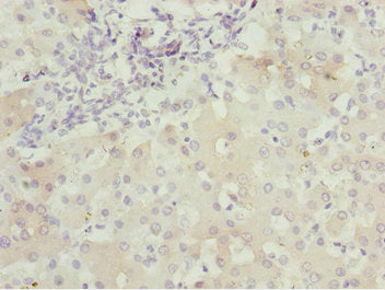 BNIP1 Antibody