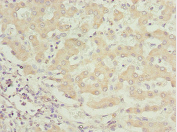 BNIP1 Antibody