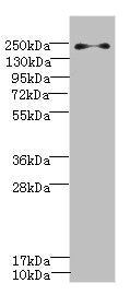 PLA2R1 Antibody
