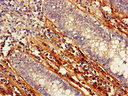 PTCH1 Antibody