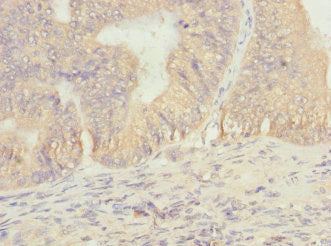 EIF2B1 Antibody