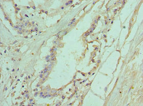 IL11RA Antibody