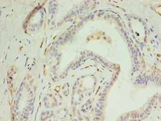 DIP2A Antibody