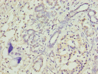 TRAM2 Antibody