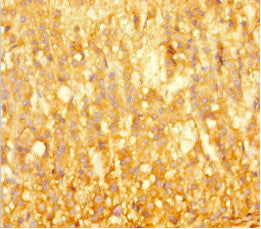 BRD3 Antibody