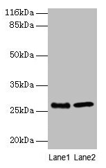 EBP Antibody
