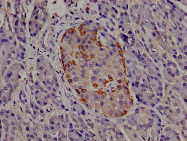 TRIP10 Antibody