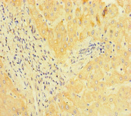 JMJD1C Antibody