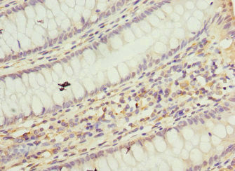 TAF12 Antibody
