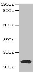TPD52L1 Antibody