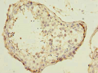 ESRG Antibody
