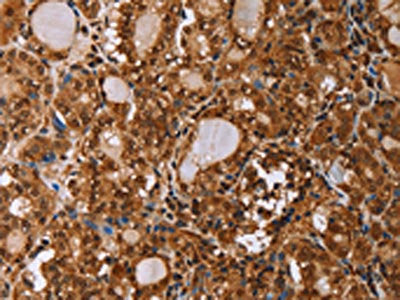 IHH Antibody