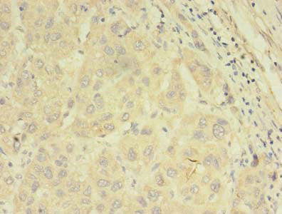 ABCB5 Antibody