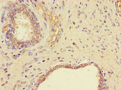 NGF Antibody