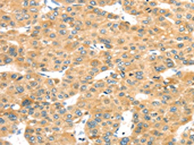 MAPK12 Antibody