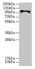 HKDC1 Antibody